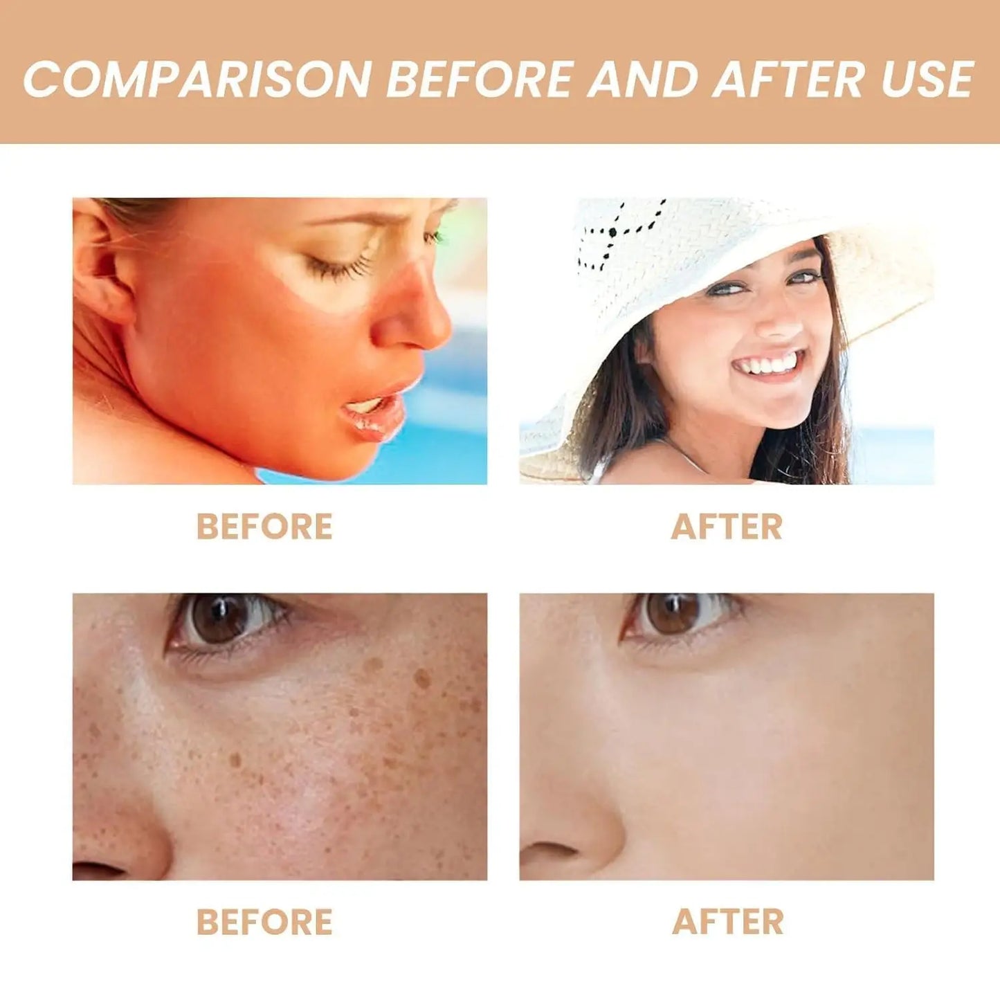 Comparison showing skin improvement before and after using Beauty of Joseon Relief Sun : Rice + Probiotics 50ml (2pcs), highlighting reduced redness and clearer, smoother complexion.