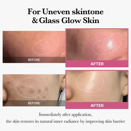 Before and after comparison of medicube collagen jelly cream 50ml showing even skin tone and glass glow effect