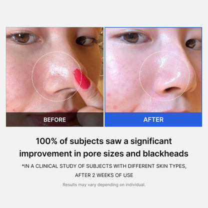 medicube Zero Pore Pads 155g 70pcs