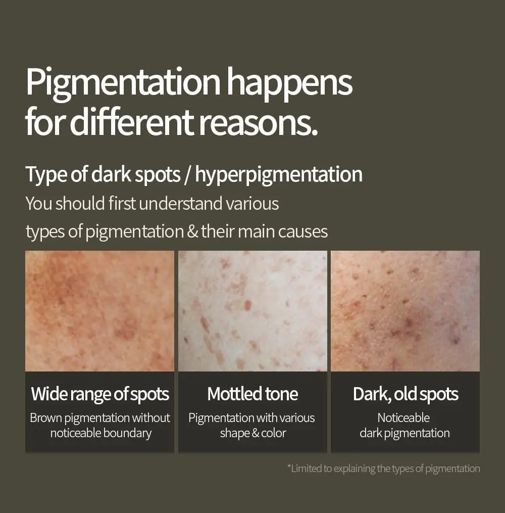 Informative graphic explaining pigmentation causes and types of dark spots including wide range of spots with brown pigmentation, mottled tone with varied shapes and colors, and dark old spots with noticeable pigmentation, related to Anua Green Lemon Vitamin C Blemish Serum 20ml.