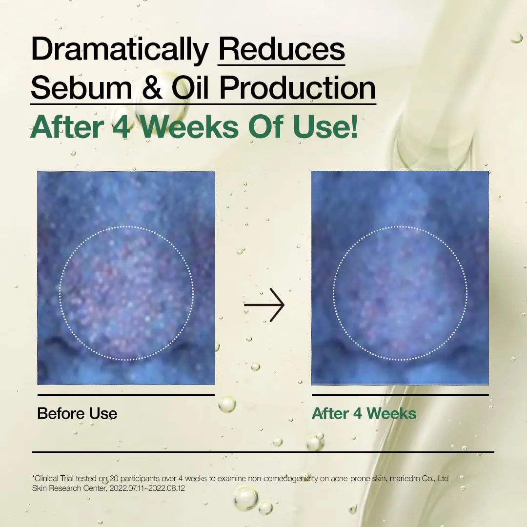 Before and after close-up images showing reduced sebum and oil production on skin after 4 weeks of using Anua Heartleaf Pore Control Cleansing Oil 200ml.