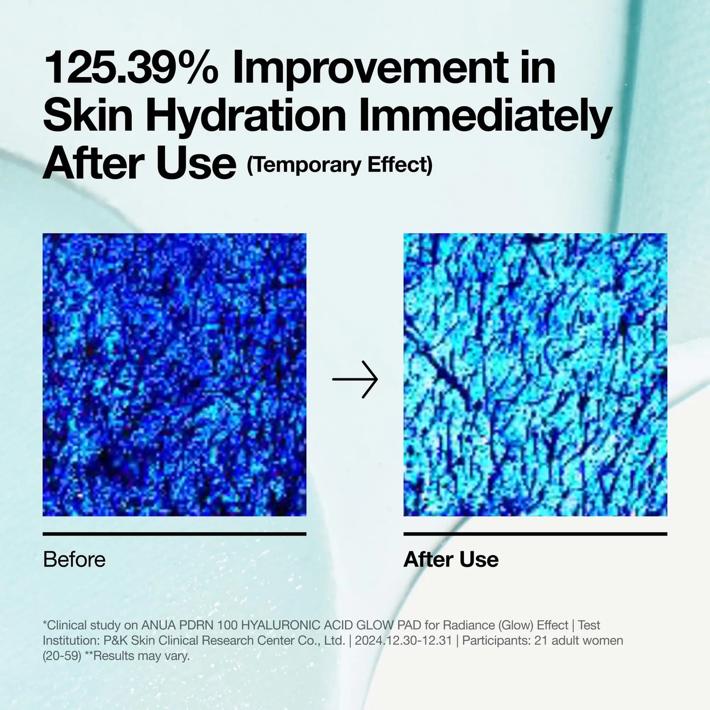Clinical image showing a 125.39% improvement in skin hydration immediately after using Anua PDRN Hyaluronic Glow Pad 180ml, with before and after skin moisture scans.