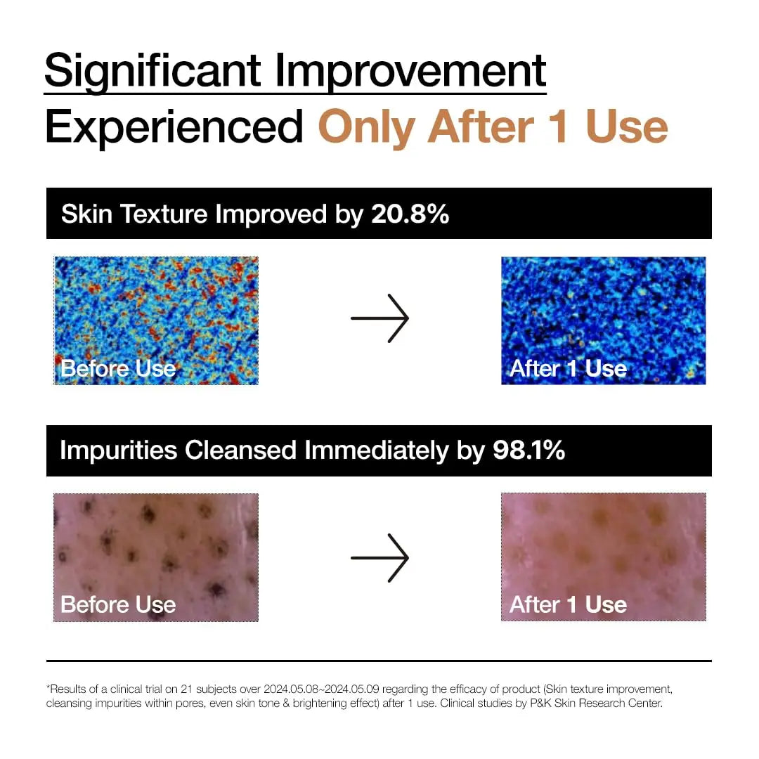 Comparison images showing skin texture improvement by 20.8% and impurities cleansing by 98.1% after one use of Anua Rice Enzyme Brightening Cleansing Powder 40g, with before and after close-ups.