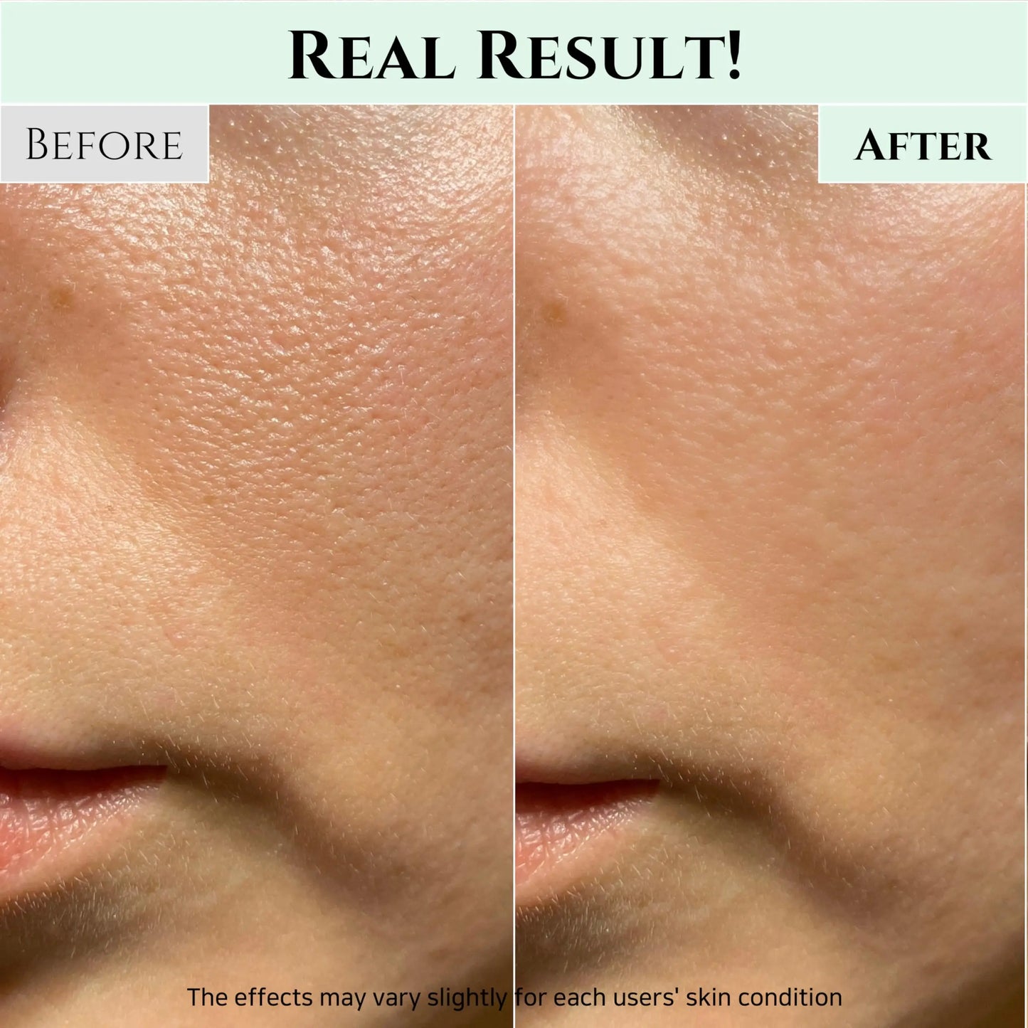 Close-up comparison of facial skin before and after using Beauty of Joseon Green Plum Refreshing Cleanser 100ml, showing reduced pores and smoother texture.