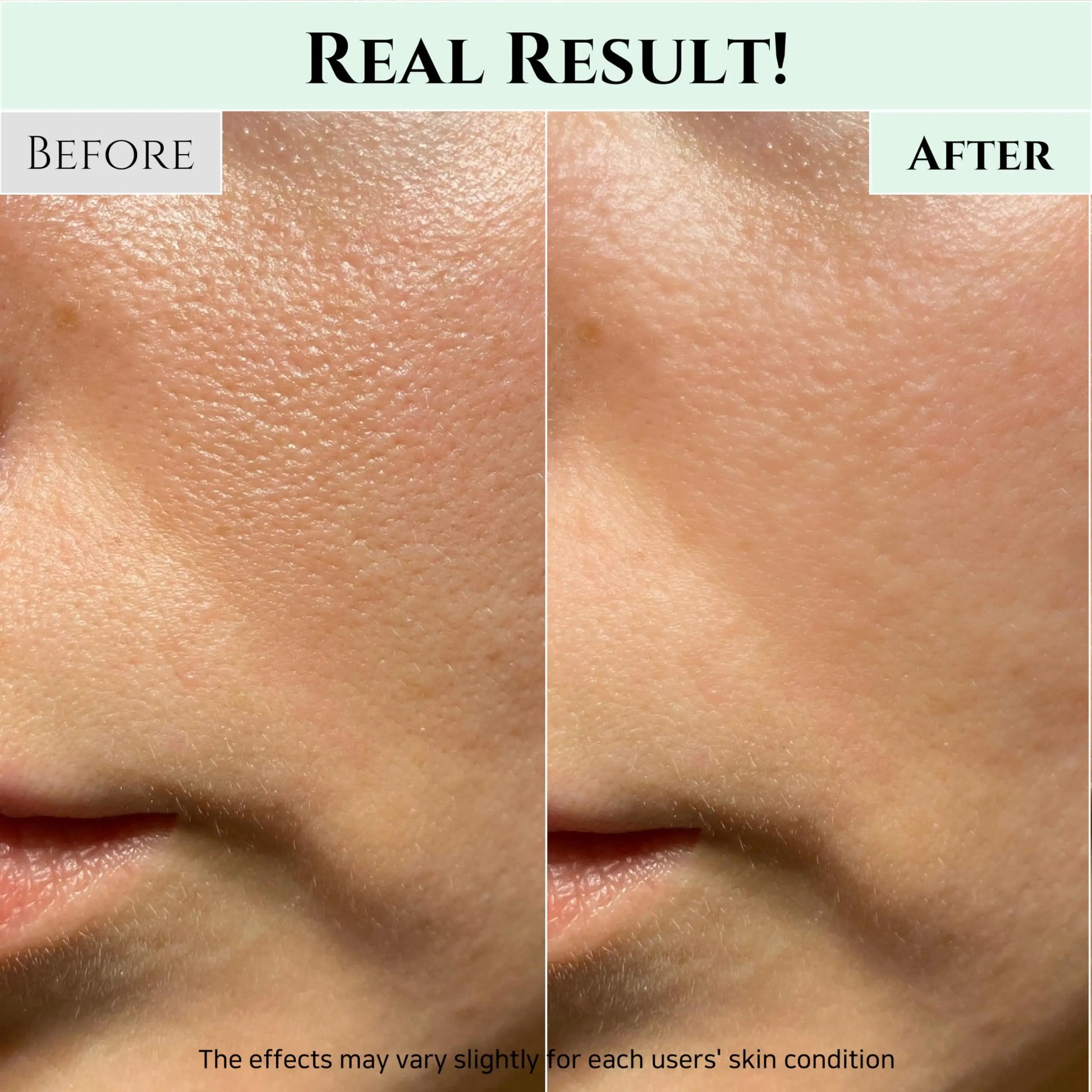 Close-up comparison of facial skin before and after using Beauty of Joseon Green Plum Refreshing Cleanser 100ml, showing reduced pores and smoother texture.