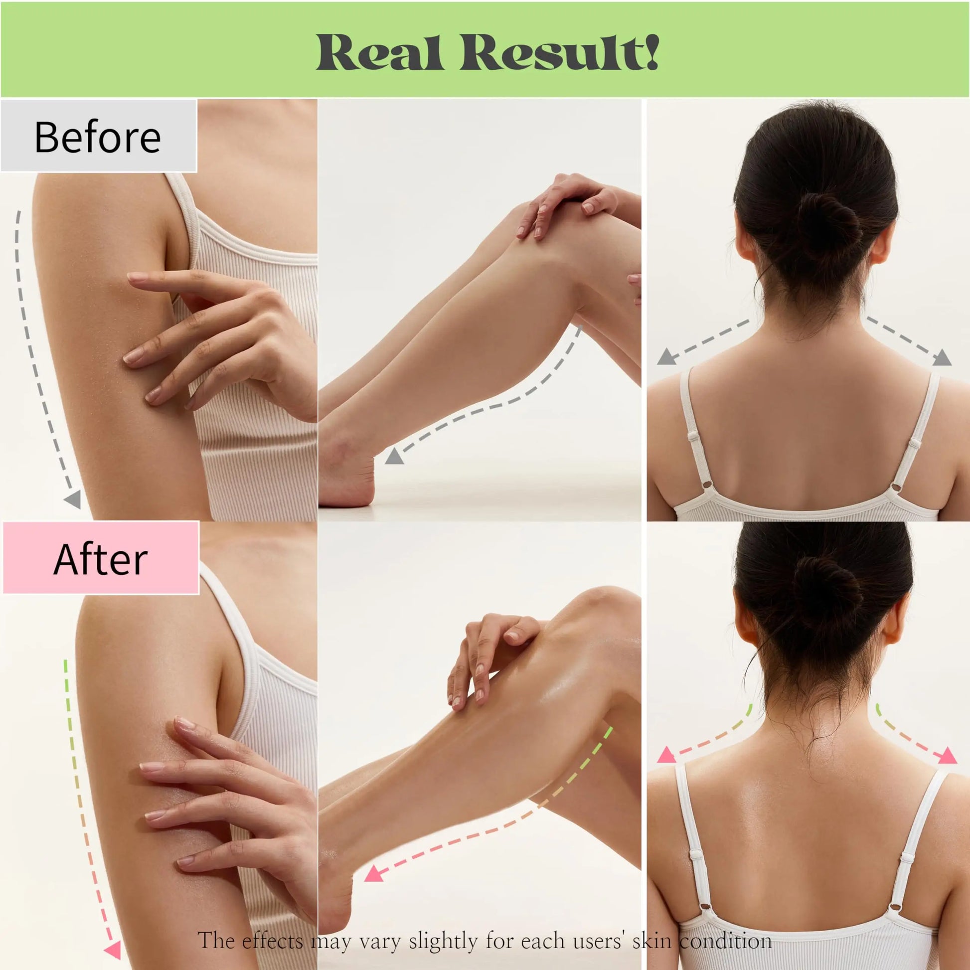 Comparison of before and after photos showing smoother and more moisturized skin on arms, legs, and back after using Beauty of Joseon Jelloskin Massage Cream for Face and Body 200ml.