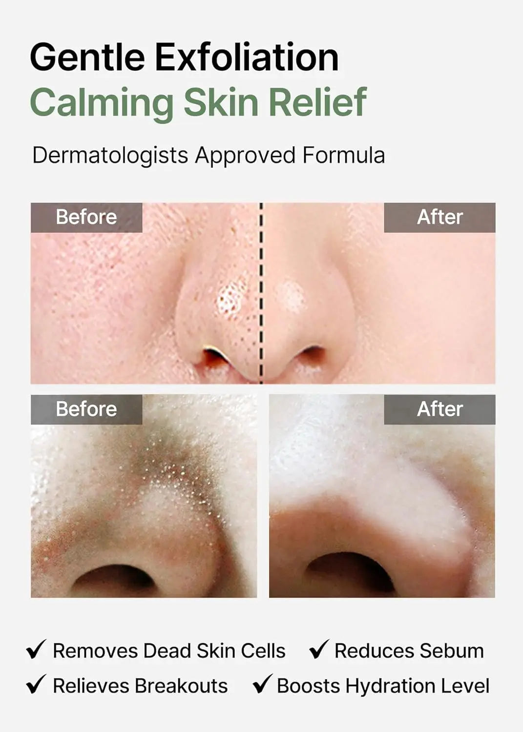 Before and after close-up images showing visible improvement in skin texture and clarity on the nose, demonstrating gentle exfoliation and calming skin relief with celimax Ji.Woo.Gae Heartleaf BHA Peeling Pad (60 Pads).