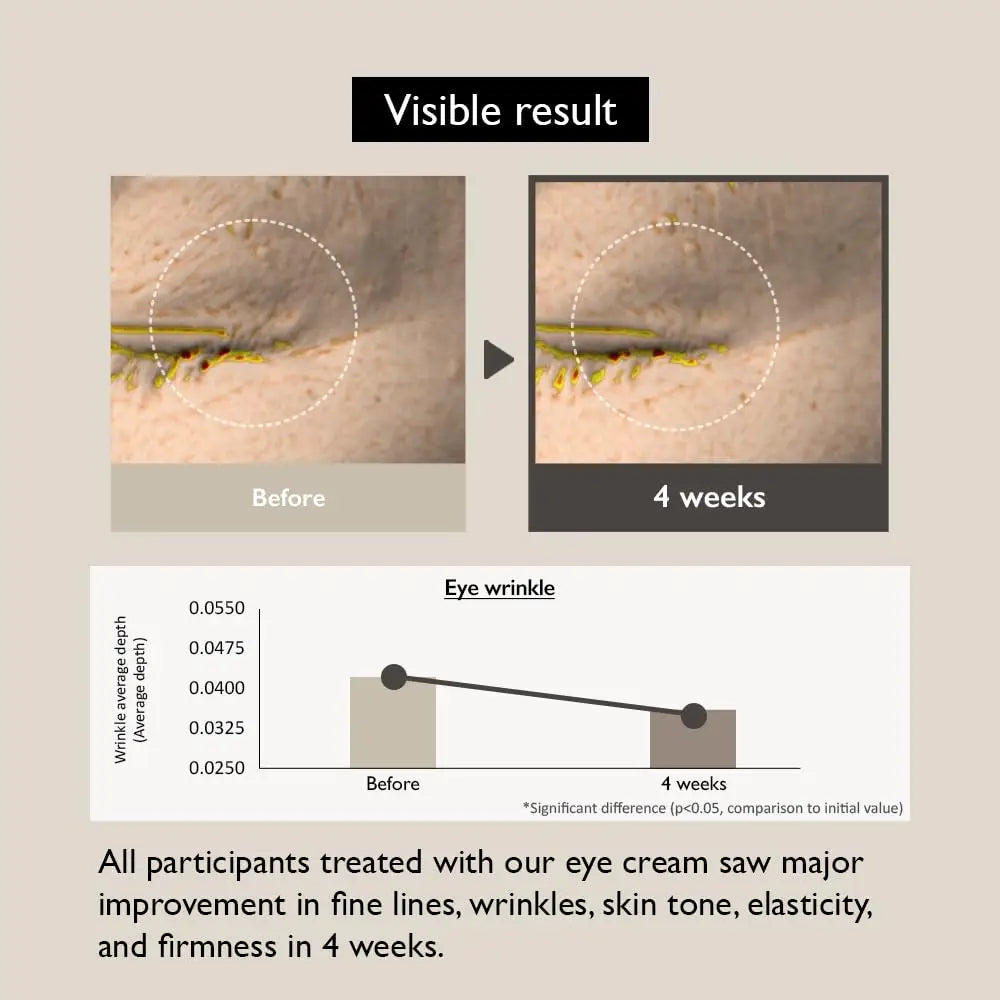 Comparison of eye wrinkle reduction before and after 4 weeks of using haruharu wonder Black Rice Bakuchiol Eye Cream 20ml, 2pcs, showing visible improvement in fine lines and skin texture.