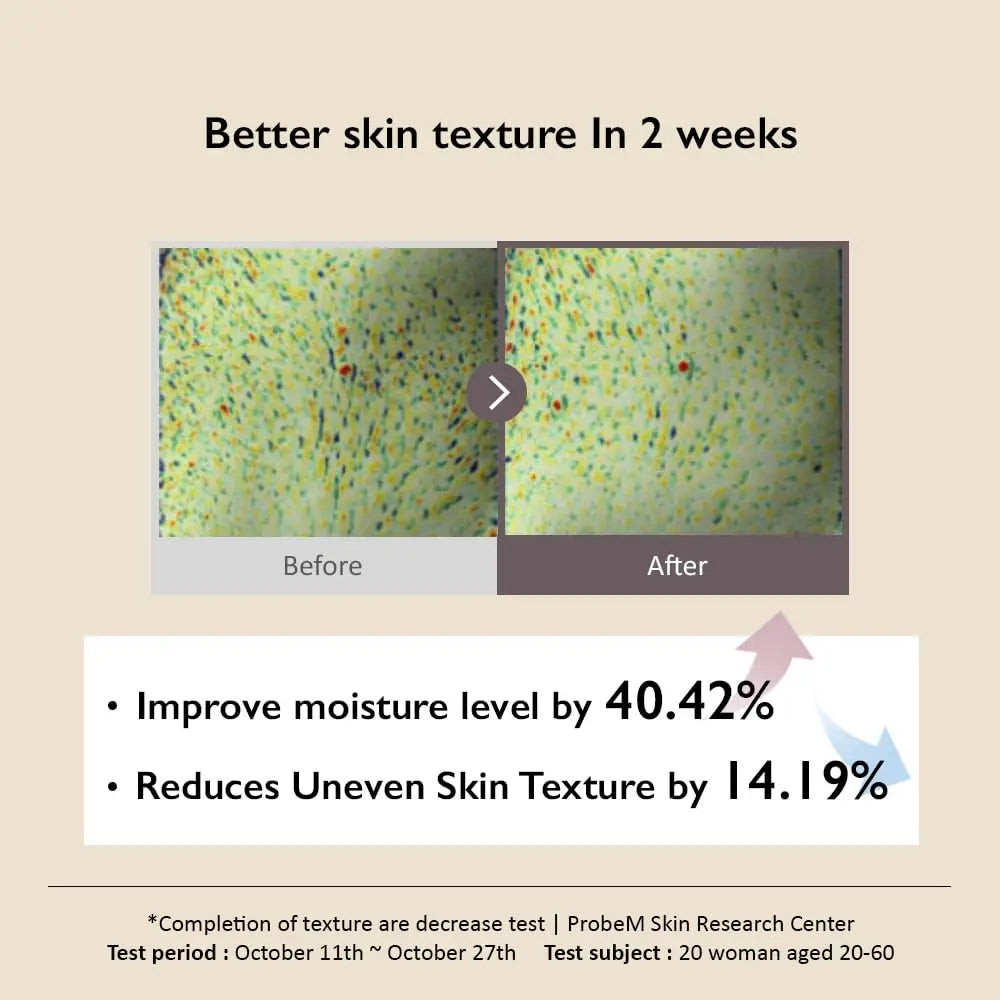 Comparison image showing improved skin texture after using haruharu wonder Black Rice Hyaluronic Toner 300ml for two weeks, with moisture level increased by 40.42% and uneven skin texture reduced by 14.19%.