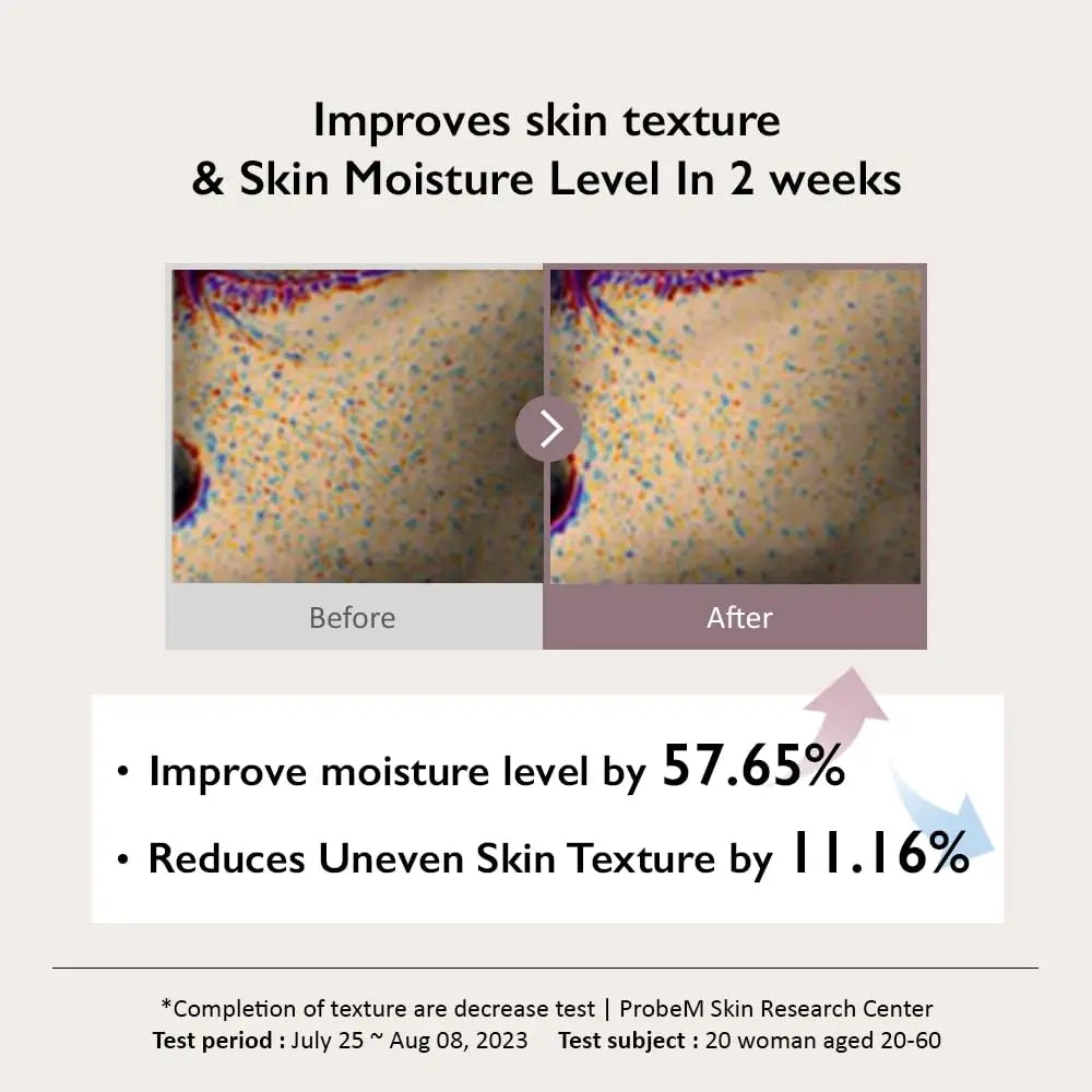 Before and after microscopic skin images demonstrating improved skin texture and moisture level after using haruharu wonder Black Rice Hyaluronic Toner for Sensitive Skin 50ml for two weeks, showing a 57.65% increase in moisture and 11.16% reduction in uneven texture.