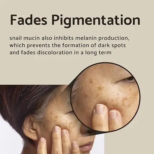 Fades pigmentation text with close-up on a person’s cheek showing dark spots and discoloration illustrating the effect of iUNIK Black Snail Restore Cream 60ml in reducing pigmentation over time.