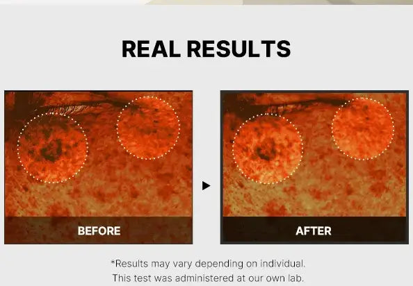 Close-up comparison of skin texture and spots showing the before and after effects of medicube AGE-R VITA C PRO AMPOULE 20ml, highlighting visible improvement in skin clarity.
