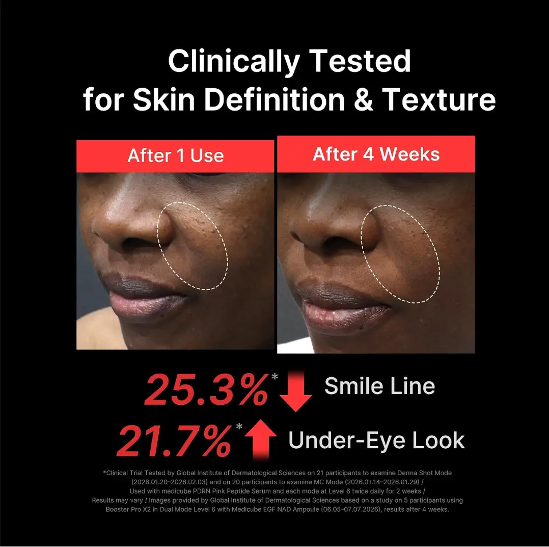 Clinical before and after showing improved skin texture using medicube booster pro x2 pdrn pink peptide serum results