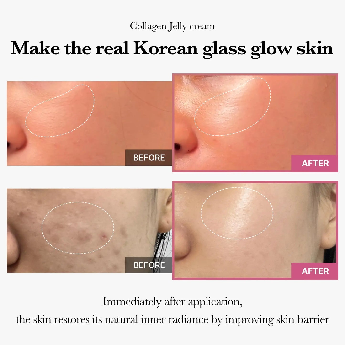 medicube Oneday Exosome Shot 7500 30ml + Medicube Collagen Jelly Cream 50ml showing before and after close-up images of skin areas with improved glow and radiance after application.