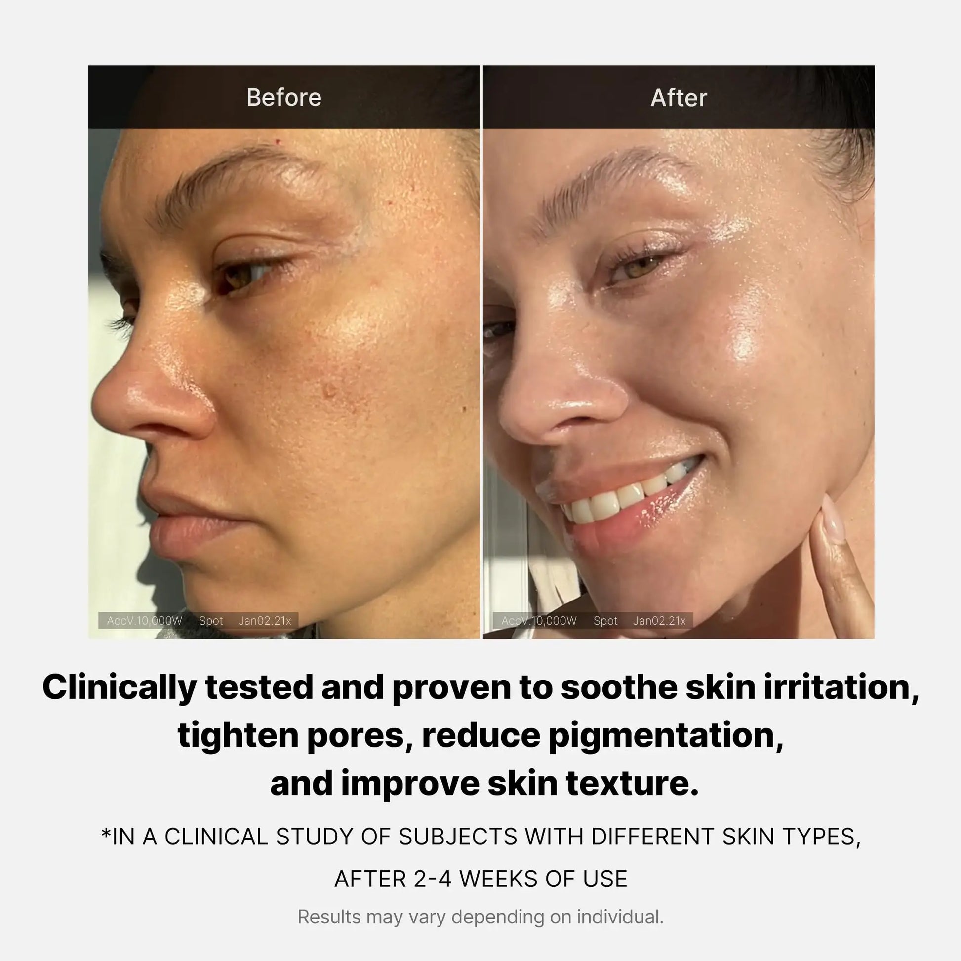 Side-by-side before and after photos showing improved skin texture, reduced pigmentation, tightened pores, and soothed irritation after using medicube Triple Collagen Cream 50ml for 2-4 weeks