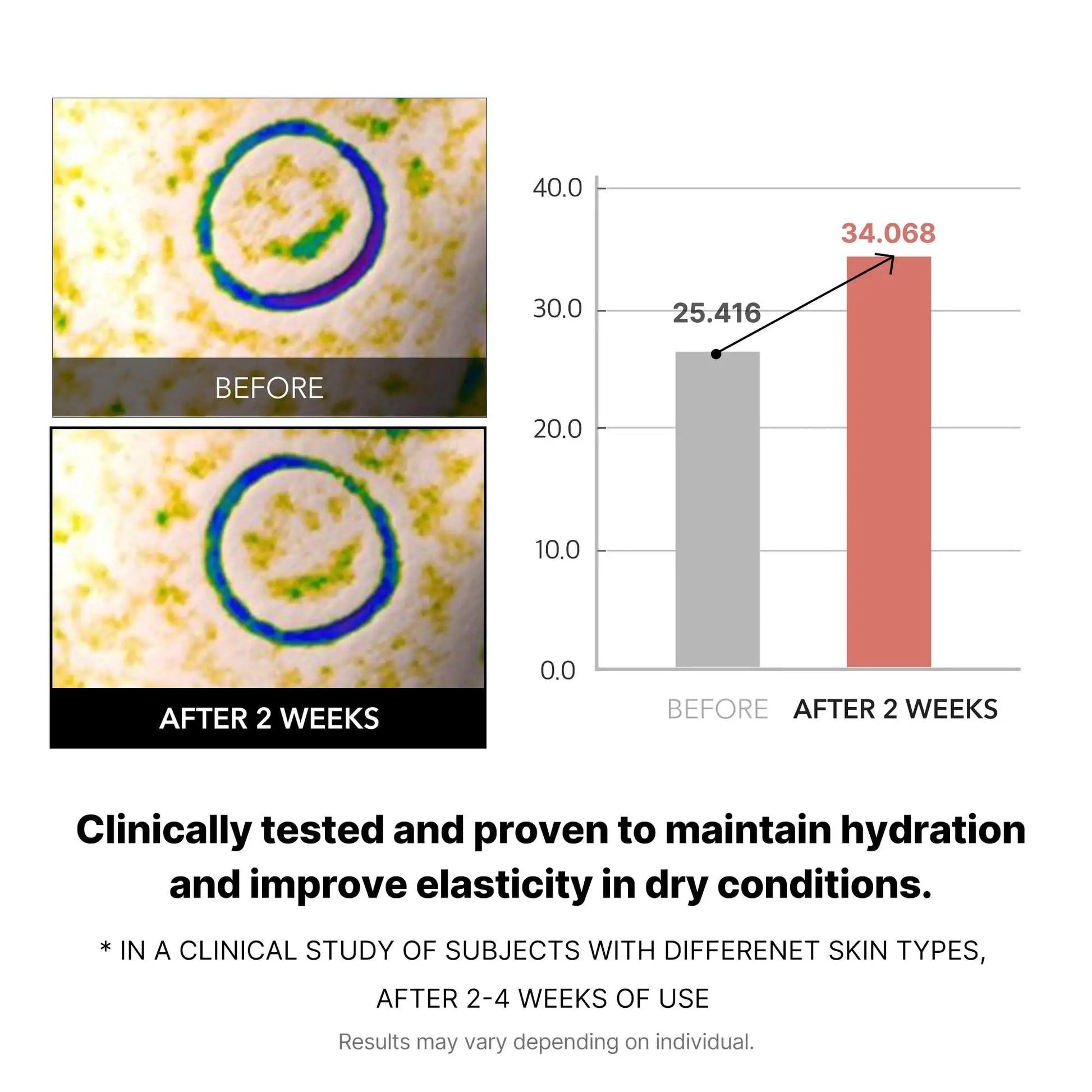 microscopic comparison of skin cells before and after 2 weeks use alongside bar graph showing increased hydration and elasticity, promoting medicube Triple Collagen Toner 140ml benefits