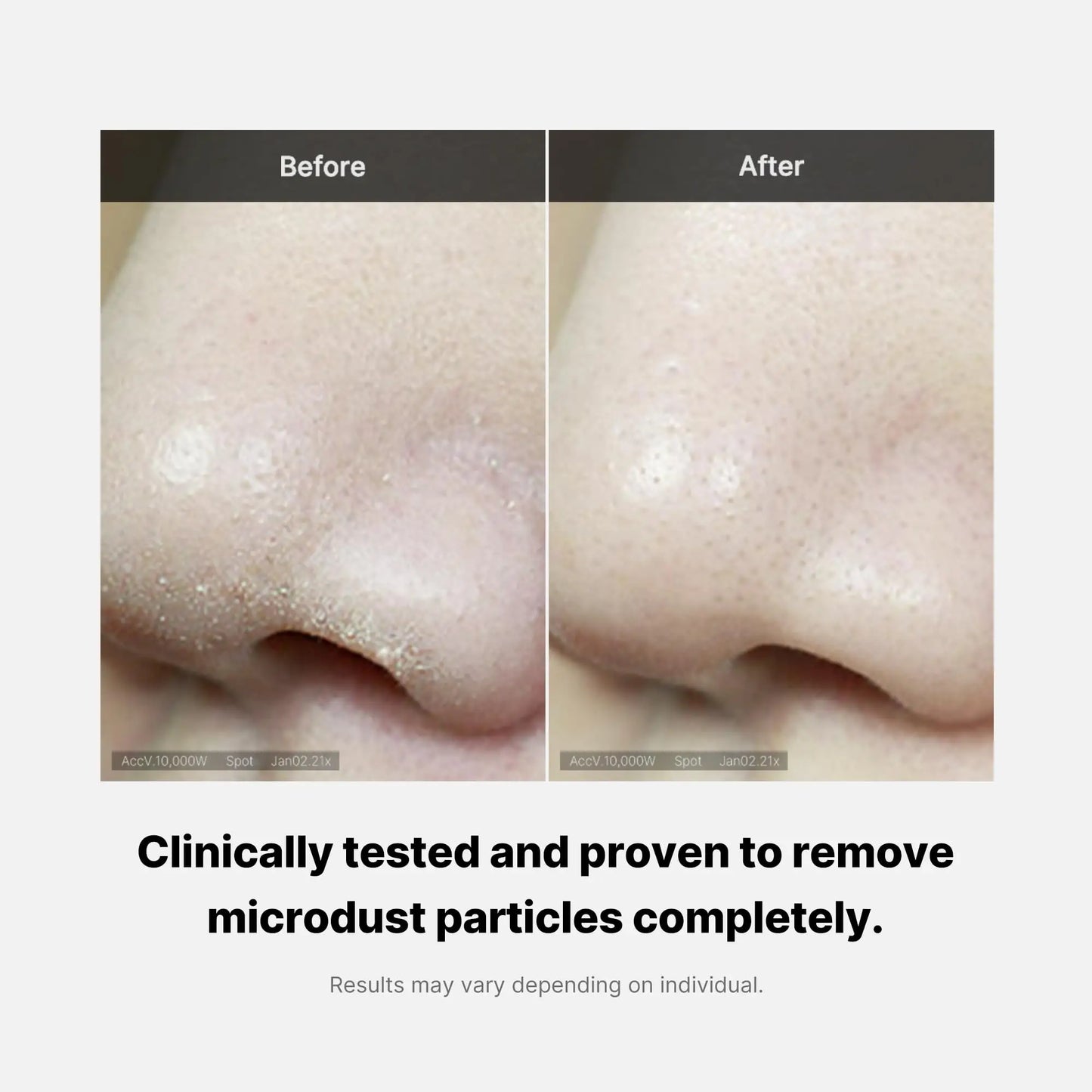 Comparison of nose skin before and after using medicube Zero Foam Cleanser 120g, showing visibly reduced microdust particles and clearer pores.