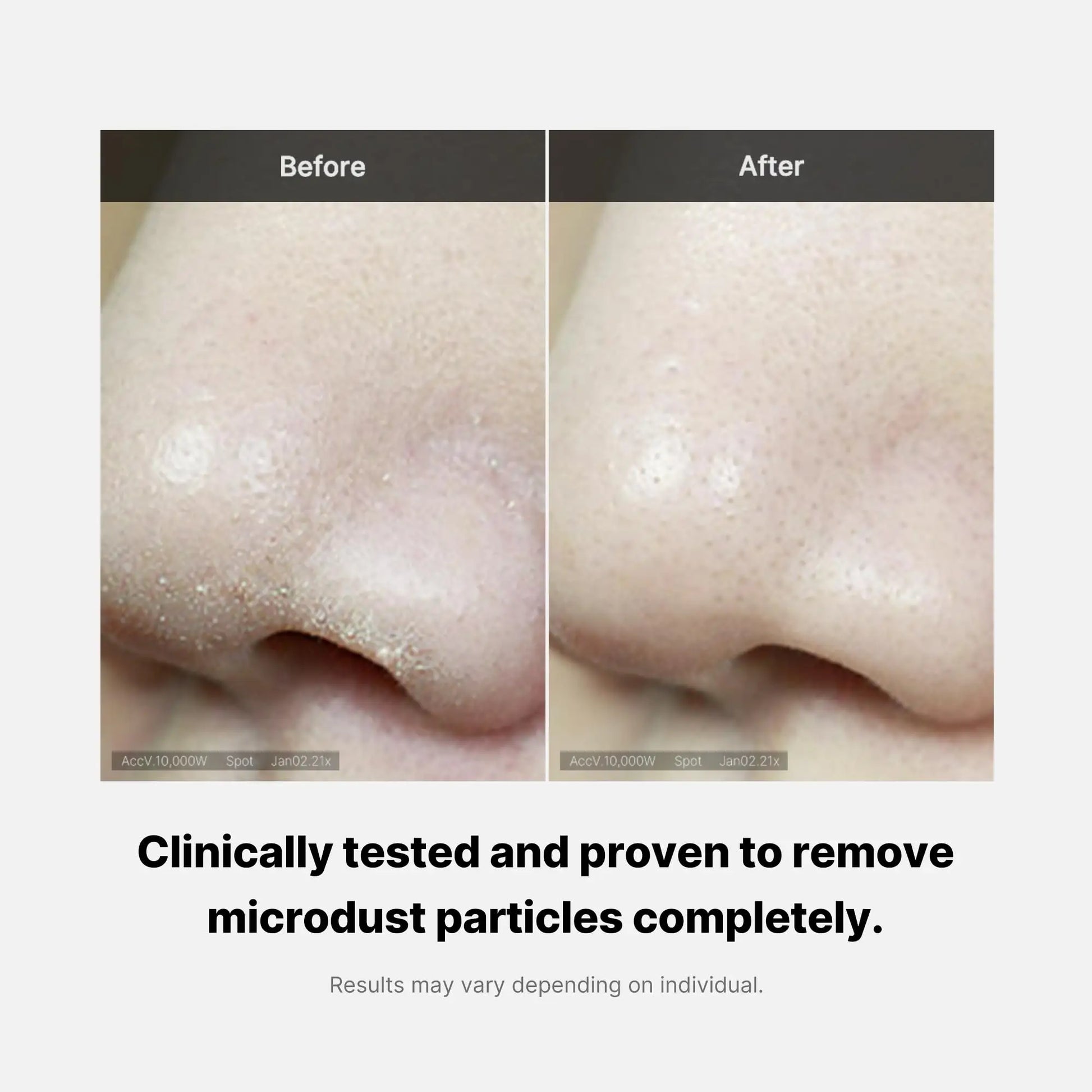 Comparison of nose skin before and after using medicube Zero Foam Cleanser 120g, showing visibly reduced microdust particles and clearer pores.