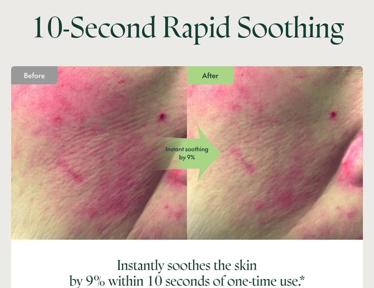 Close-up comparison of irritated skin showing redness and bumps before and after applying PURITO Seoul Wonder Releaf Centella Toner 200ml, demonstrating rapid soothing effect in 10 seconds.