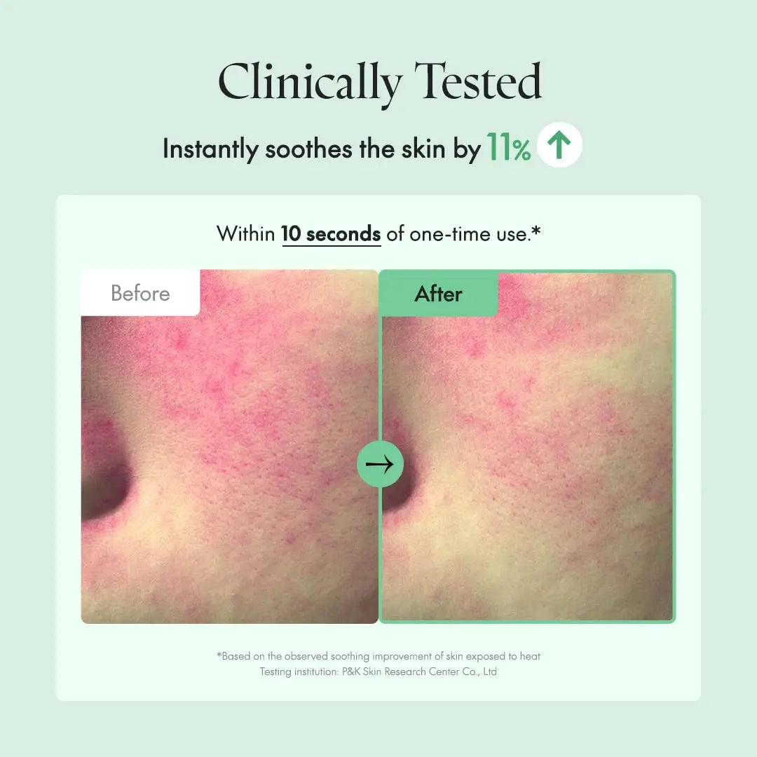 Comparison showing skin redness reduction before and after using PURITO Seoul Wonder Releaf Centella Toner Unscented, clinically tested to soothe skin by 11% within 10 seconds.