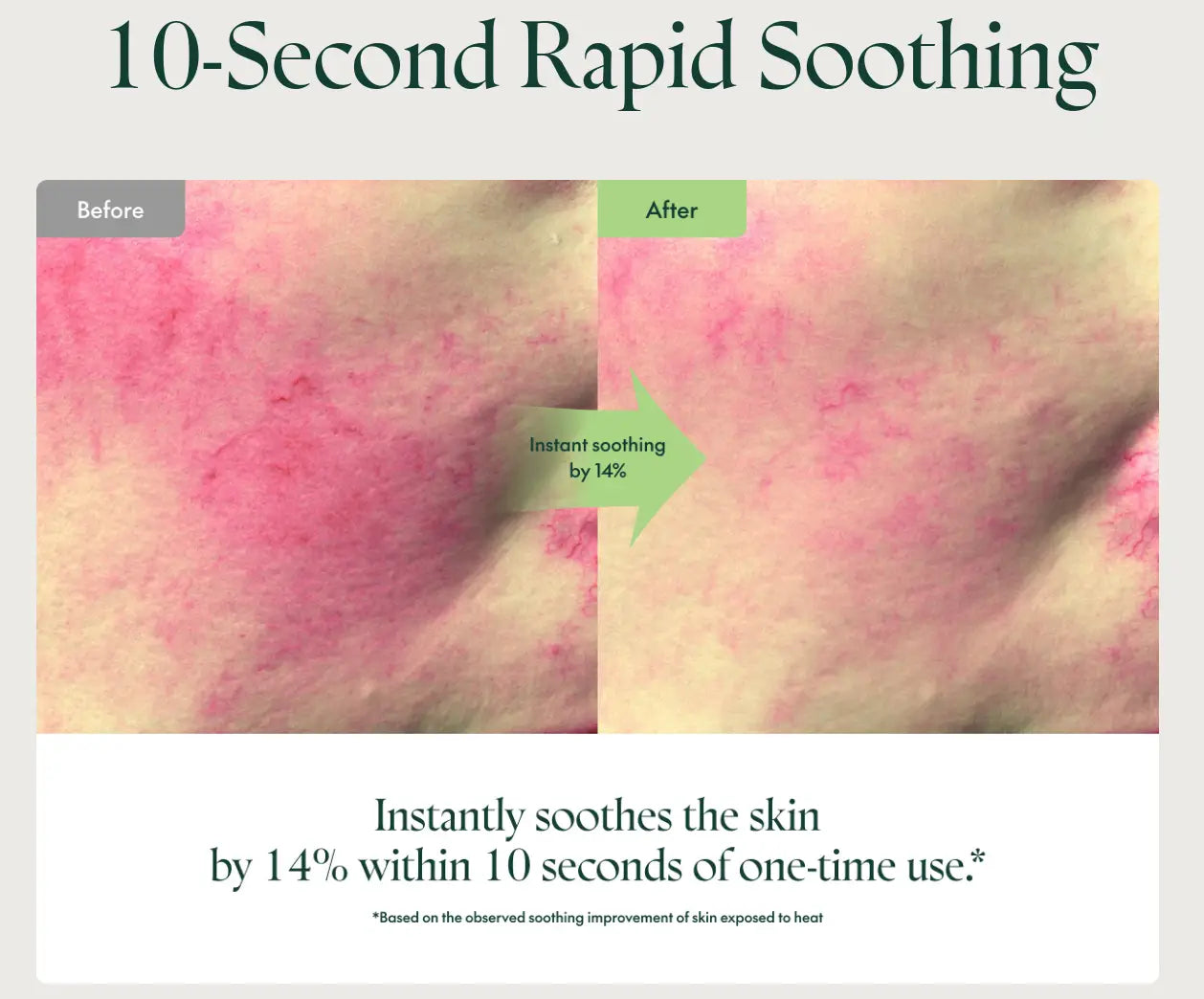 Comparison of red, irritated skin before and after using PURITO Wonder Releaf Centella Cream 50ml, showing a 14% reduction in redness within 10 seconds for rapid soothing.