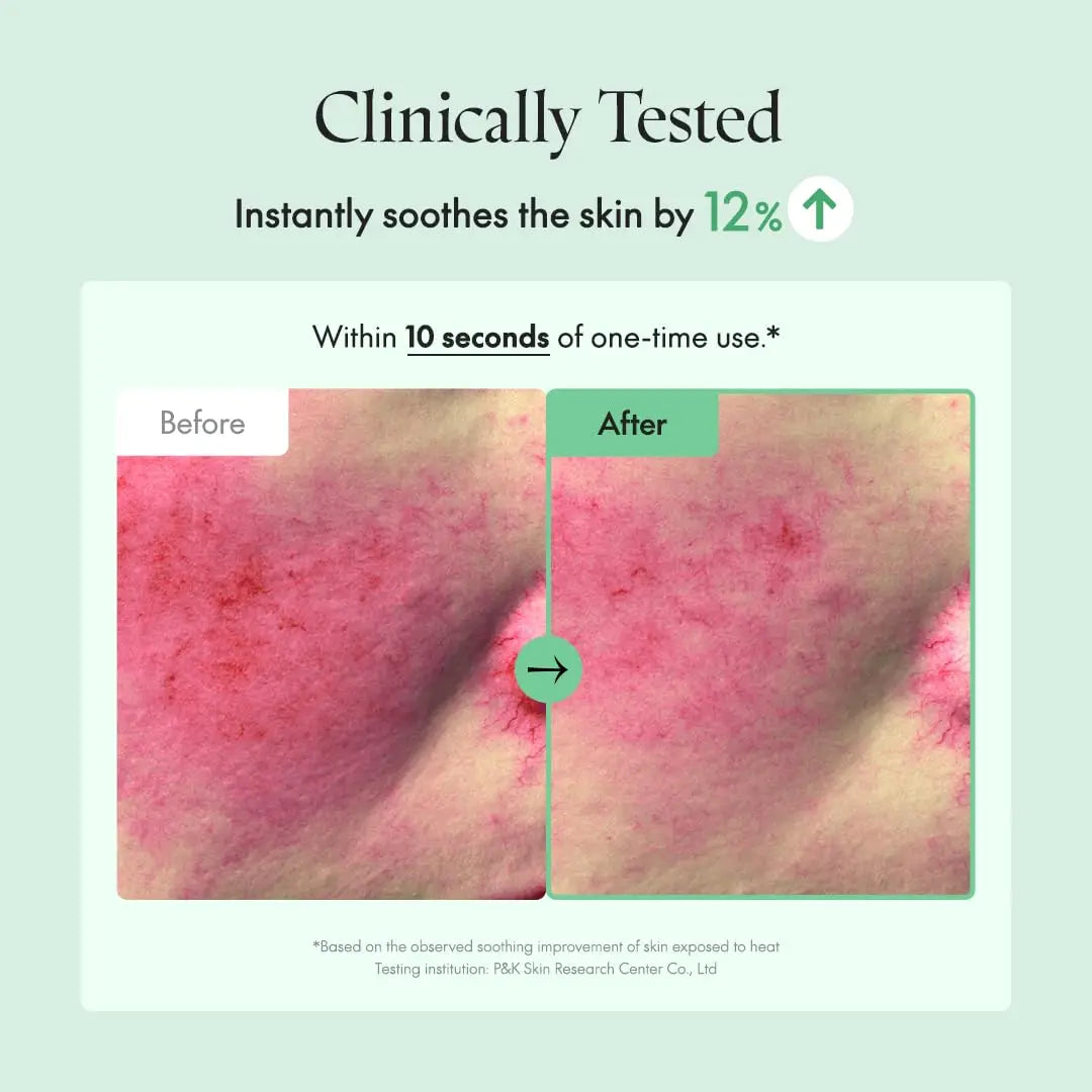 Before and after close-up images showing skin redness reduction and soothing effects within 10 seconds, demonstrating the efficacy of PURITO Wonder Releaf Centella Cream Unscented.