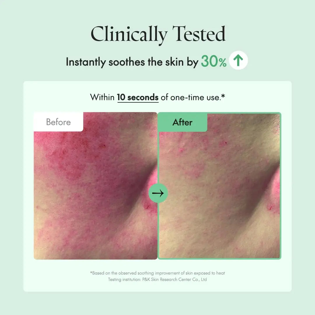 Comparison of skin redness before and after using PURITO Wonder Releaf Centella Eye Cream Unscented 30ml showing a 30% reduction in skin irritation within 10 seconds of one-time use.