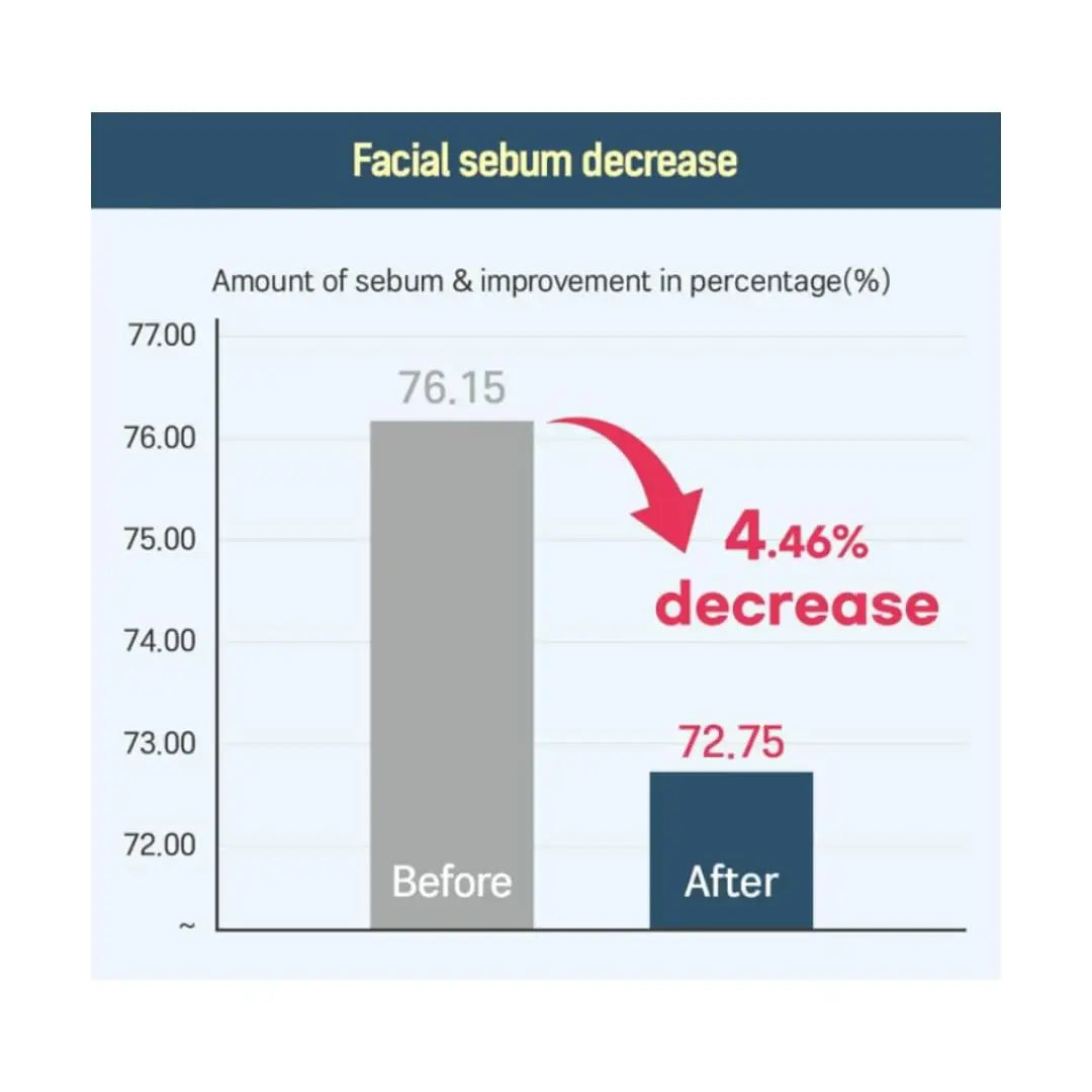 Graph showing facial sebum decrease of 4.46% after using Round LAB 1025 Dokdo Toner 200ml + Dokdo Lotion 200ml, with before and after percentages of 76.15% and 72.75% respectively.
