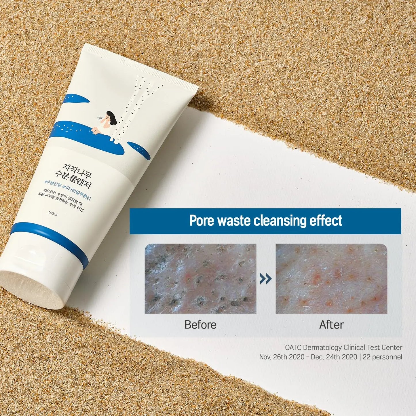 ROUND LAB Birch Juice Moisturizing Cleanser 150ml shown with before and after close-up images demonstrating pore waste cleansing effect on skin.