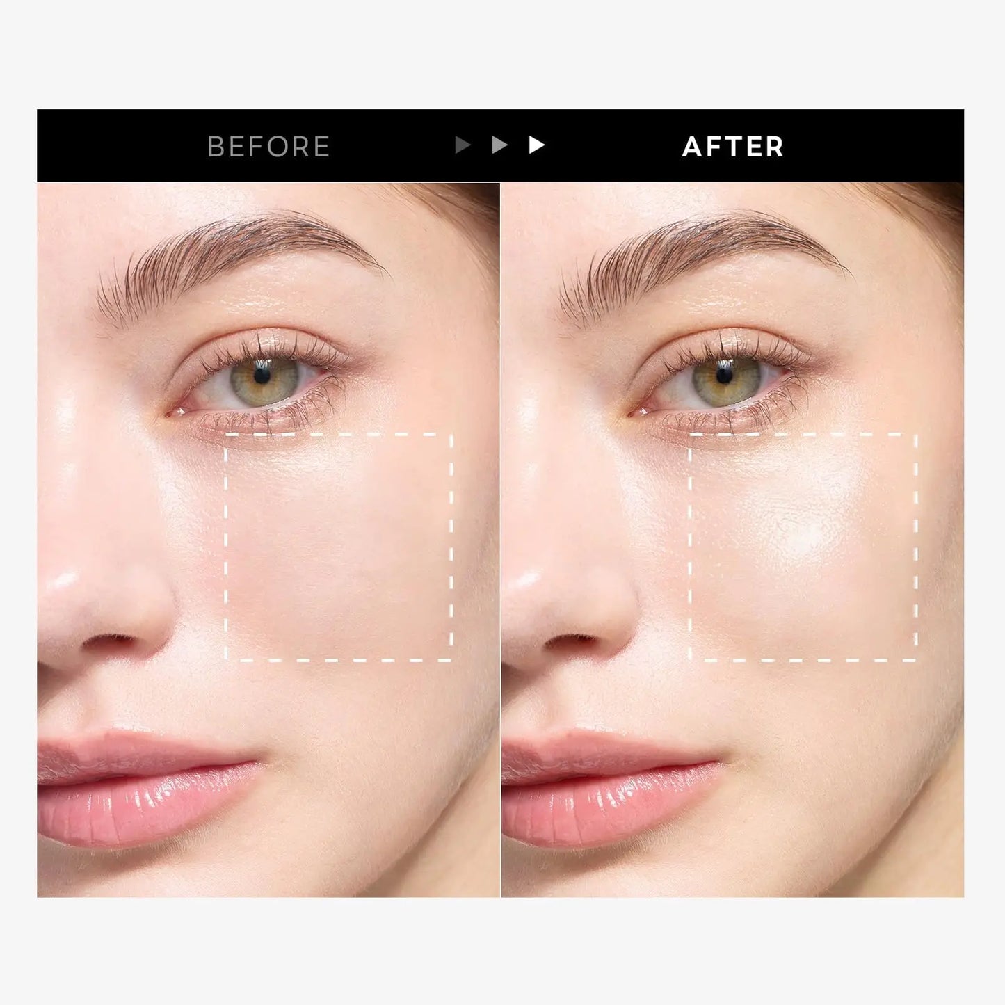 Comparison of a woman's cheek before and after using ROUND LAB Birch Juice Moisturizing Sunscreen 50ml, showing enhanced hydration and a radiant glow on the skin.