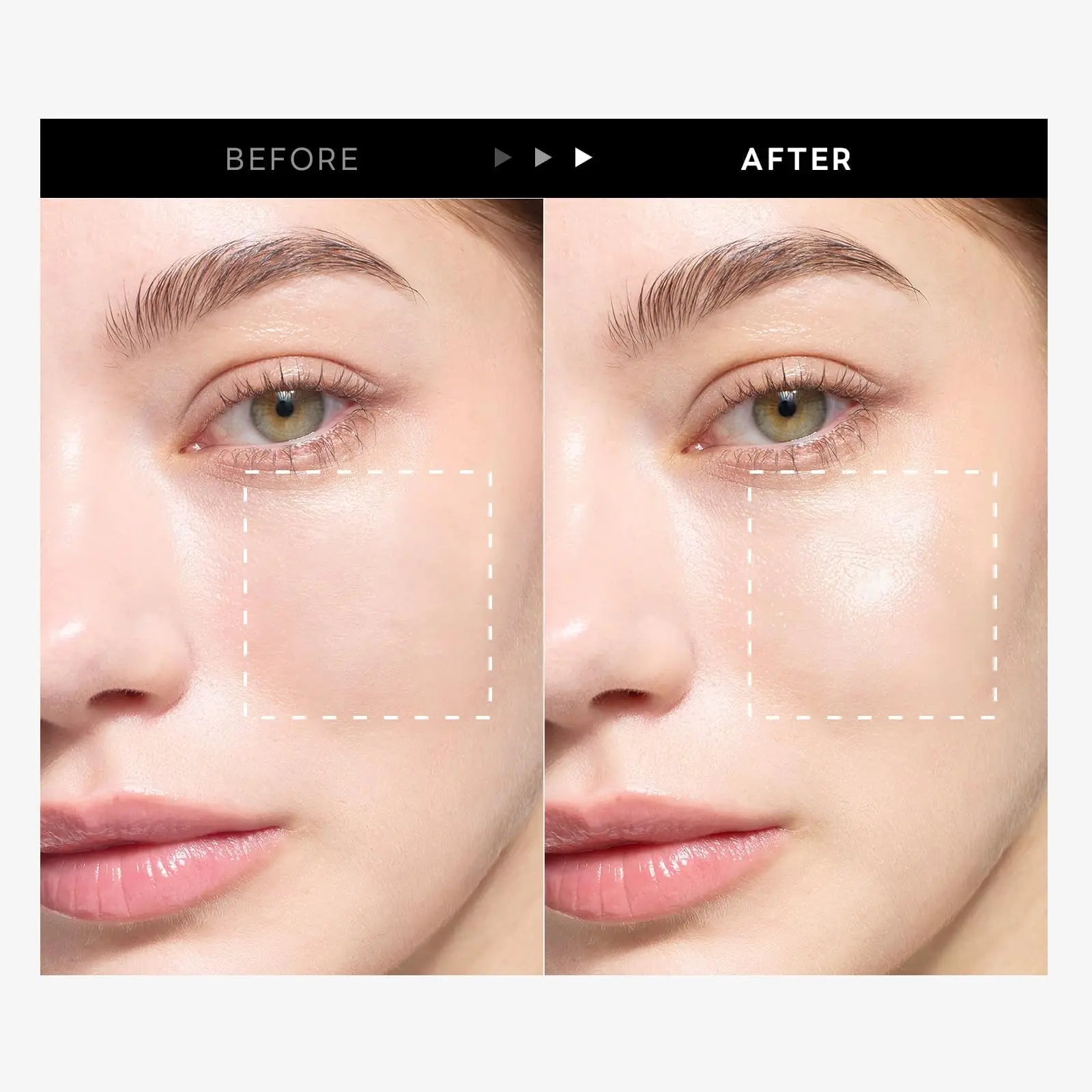 Comparison of a woman's cheek before and after using ROUND LAB Birch Juice Moisturizing Sunscreen 50ml, showing enhanced hydration and a radiant glow on the skin.