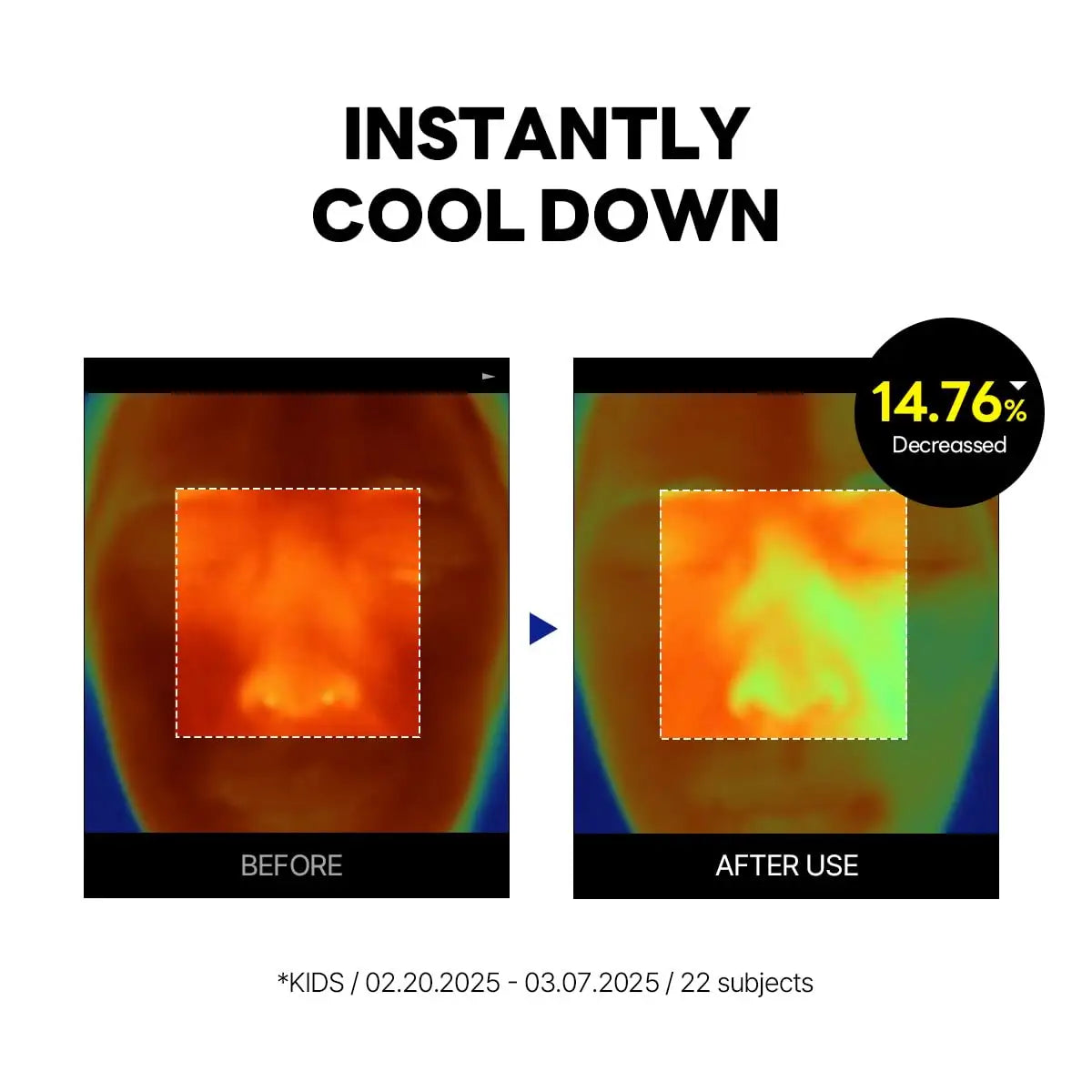 Thermal images showing a child's face before and after applying Round Lab Birch Juice Moisturizing UVLock Sun Cushion 15g, demonstrating a 14.76% decrease in skin temperature for instant cooling effect.