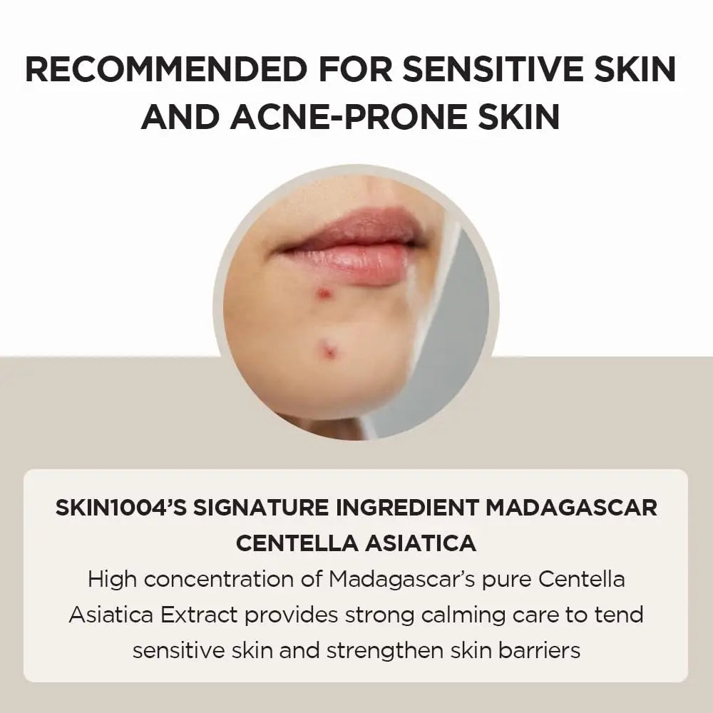 Close-up image of a person's lower face with acne on the chin, highlighting skin irritation, accompanied by text recommending Skin 1004 Madagascar Centella Asiatica Ampoule Facial Serum 100ml for sensitive and acne-prone skin due to its calming properties.