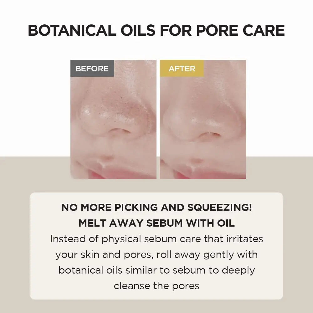 Comparison of skin pores before and after using Skin 1004 Madagascar Centella Light Cleansing Oil 200ml, showing reduced sebum and smoother skin with botanical oil cleansing benefits.