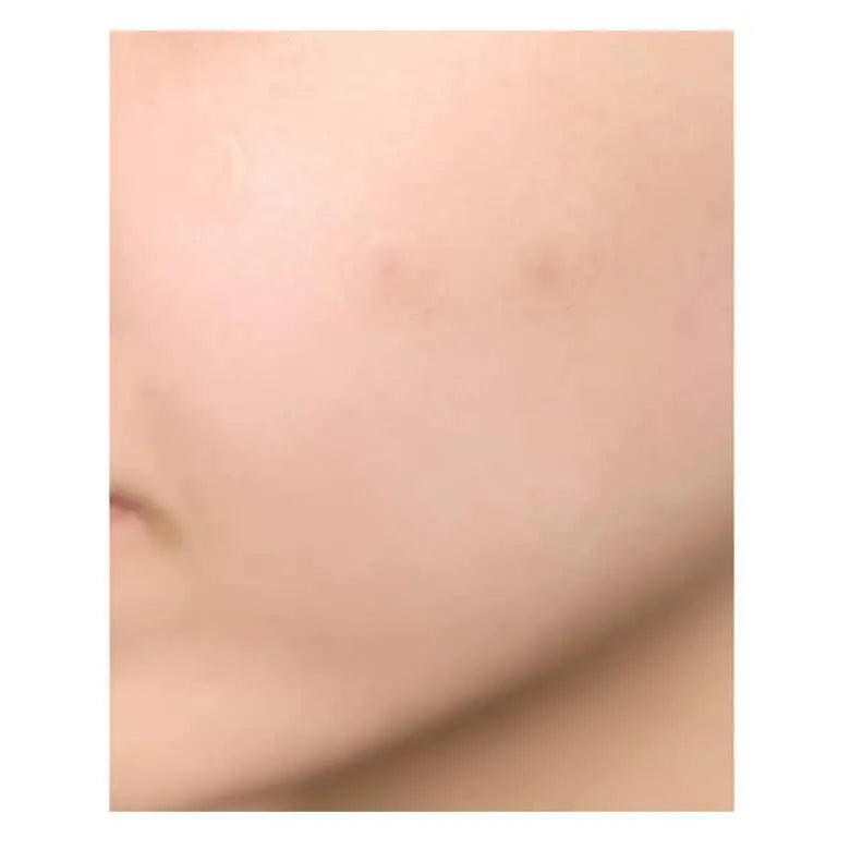 Close-up of smooth, clear facial skin highlighting natural texture, demonstrating the effect of Skin 1004 Magadascar Centella Tea-Trica Spot Cover Patch for blemish care.